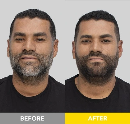 permanent black beard dye